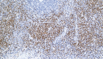 LEF1 Antibody