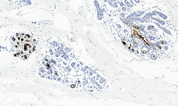 PIP Antibody