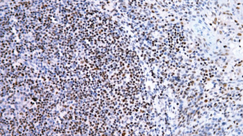 FOXP1 Antibody