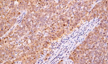 SMAD4 Antibody