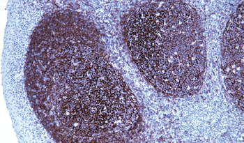 CR2 Antibody
