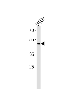 TFDP3 Antibody (N-term)