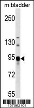 ASAH2 Antibody (C-term)