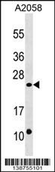 DUSP13 Antibody (C-term)