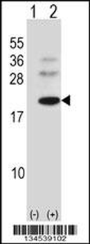 BARX1 Antibody (C-term)