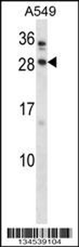 BARX1 Antibody (C-term)