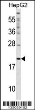 CYGB Antibody (N-term)