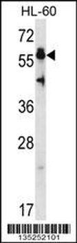 HSF4 Antibody (N-term)