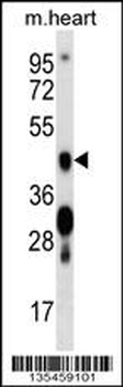 Mouse Camk4 Antibody (C-term)