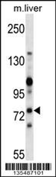 Mouse Zap70 Antibody (C-term)