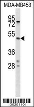 SERPINA5 Antibody (N-term)