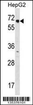 NR2C1 Antibody (C-term)
