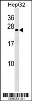 CRYGB Antibody (Center)