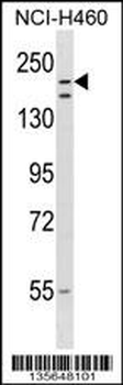RNF160 Antibody (Center)