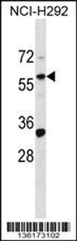 ZNF136 Antibody (N-term)