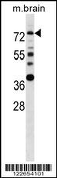 ESR1 Antibody