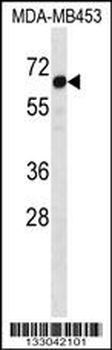STEAP3 Antibody (C-term)