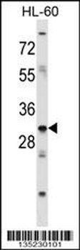 HOXB9 Antibody (Center)