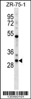 HOXD1 Antibody (N-term)