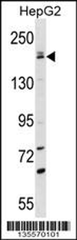 PNPLA6 Antibody (C-term)