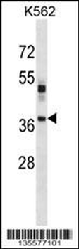 VSX1 Antibody (Center)