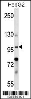 BNC1 Antibody (N-term)