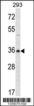 GBX1 Antibody (Center)