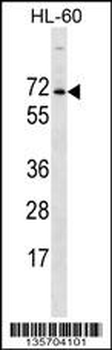 ACPL2 Antibody (Center)