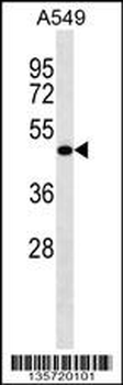LRRC26 Antibody (C-term)