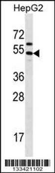 GRHL1 Antibody (Center)