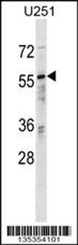 RANBP3 Antibody (N-term)