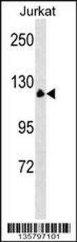 MYT1 Antibody (N-term)