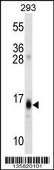 RGS8 Antibody (N-term)