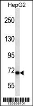 CHD1L Antibody (Center)