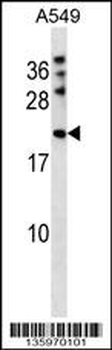 MPHOSPH6 Antibody (N-term)