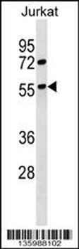 GPRC5B Antibody (C-term)