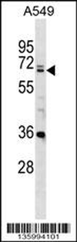 DDX28 Antibody (C-term)