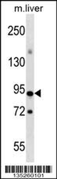 CXXC1 Antibody (Center)