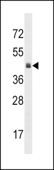 KLF12 Antibody (C-term)