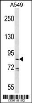 DDX53 Antibody (C-term)