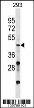 VSX2 Antibody (C-term)