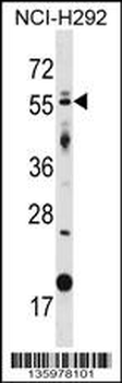 GLIS2 Antibody (Center)