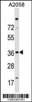 ISL2 Antibody (N-term)