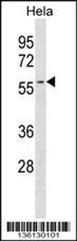 AUP1 Antibody (C-term)