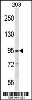 SLITRK2 Antibody (C-term)