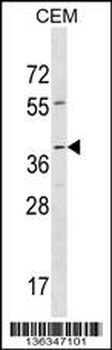 RAD52 Antibody (Center)