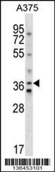 AVPR1A Antibody (C-term)