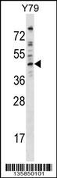 EPB49 Antibody (Center)