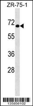 GTF3C5 Antibody (Center)