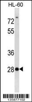 SDCBP2 Antibody (N-term)